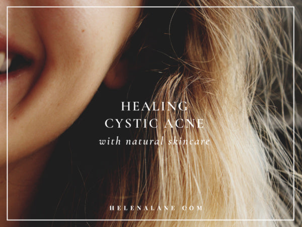 Natural Cystic Acne Treatment